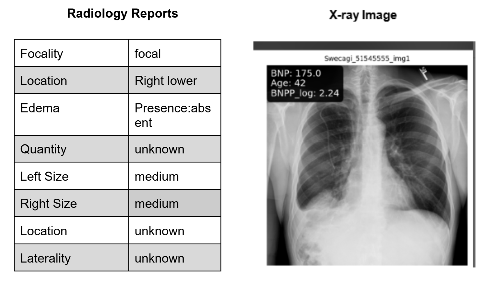 Preview of Radiologist Report and X-ray